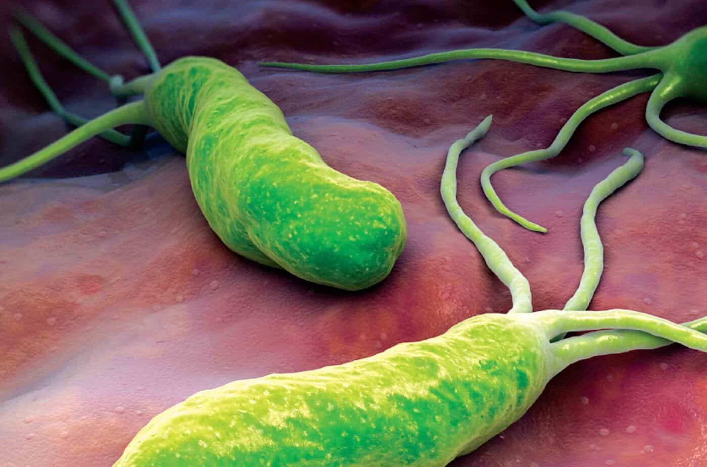 Helicobacter Pylori Co To Jest Objawy Diagnostyka Leczenie Zielarz Dietetykpl 1994